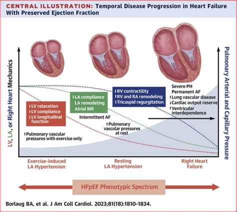 Heart Failure With Preserved Ejection Fraction Jacc Scientific