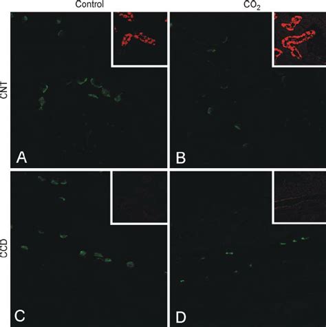 Representative Micrographs Showing Double Immunofluorescence Labeling