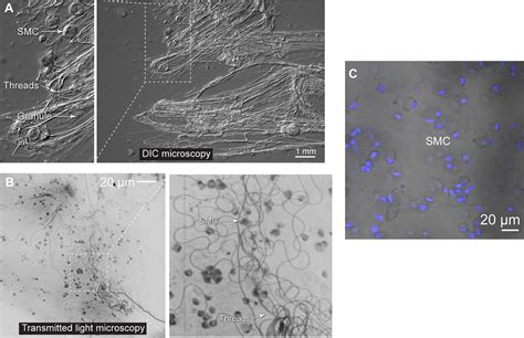 Figures And Data In Epidermal Threads Reveal The Origin Of Hagfish