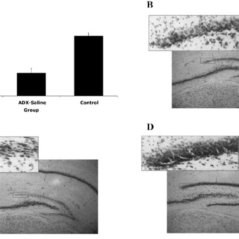 Granule Cell Layer Thickness Differed Significantly Between Groups A