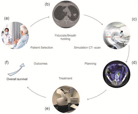 Cancers Free Full Text Stereotactic Body Radiation Therapy In