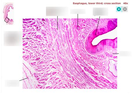 esophagus Diagram | Quizlet