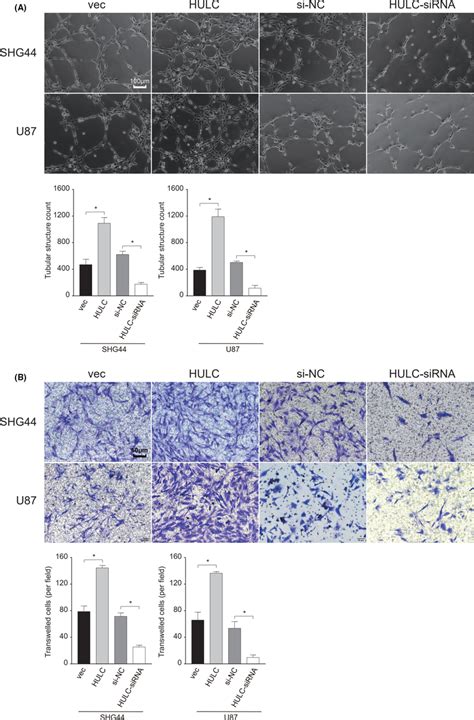 Altered LncRNA HULC Expression Modulates The Tubular Formation And