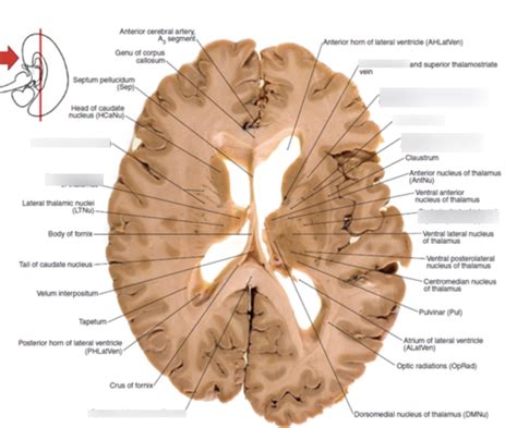 Axial Cross Section Of Brain Diagram Quizlet