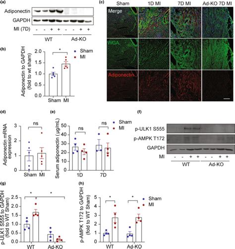 P Ulk1 Cell Signaling Technology Inc Bioz