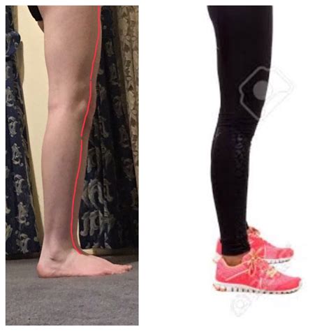 Anyone know why my legs cant fully straighten? : r/flexibility