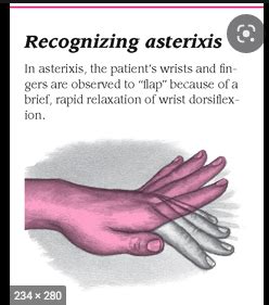 Quiz Critical Care Flashcards Quizlet