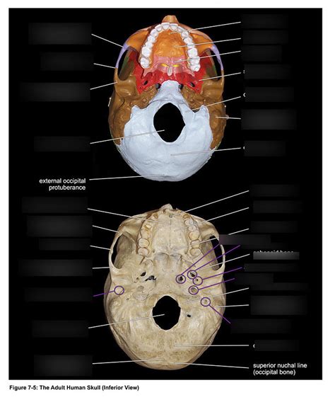 Axial Skeleton Adult Skull Inferior View Diagram Quizlet