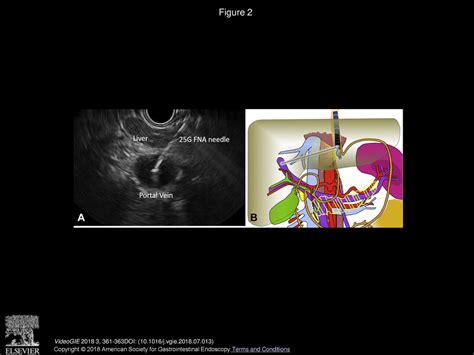 Volume 3 Issue 11 Pages November 2018 Ppt Download