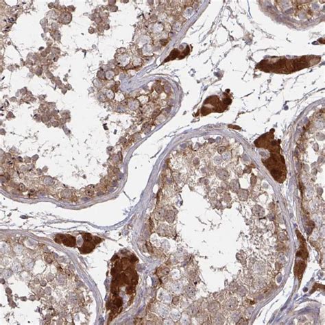 Rabbit Polyclonal Anti Ccs Antibody Buy For Research Highly