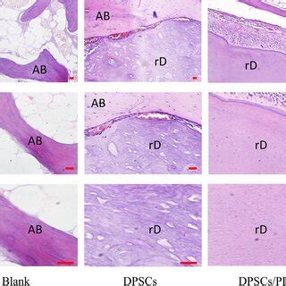 Micro CT Findings A Micro CT Showed Complete Bone Like Healing In The