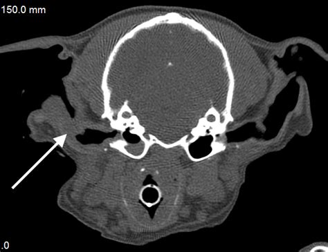 Head And Neck Tumors Ear Canal — Dr Julius M Liptak