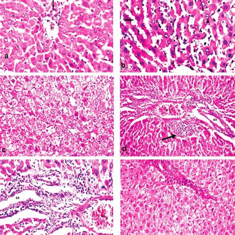 Histological Section Of Liver Of Female Rat Download Scientific Diagram