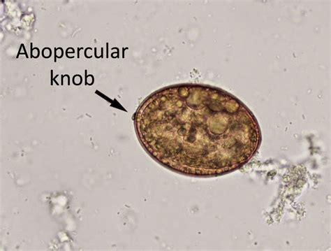 Diphyllobothrium Latum Egg