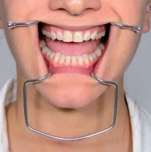 Dental Cheek Retractor