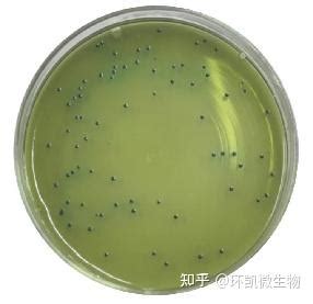 常见微生物菌落形态图及比较 知乎