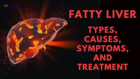 Fatty Liver Causes