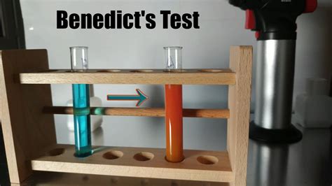 Benedict S Reagent Part Benedict S Test Youtube