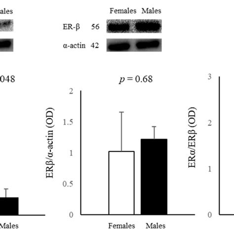 Influence Of Sex On The Expression Of Erα And Erβ Proteins In Female