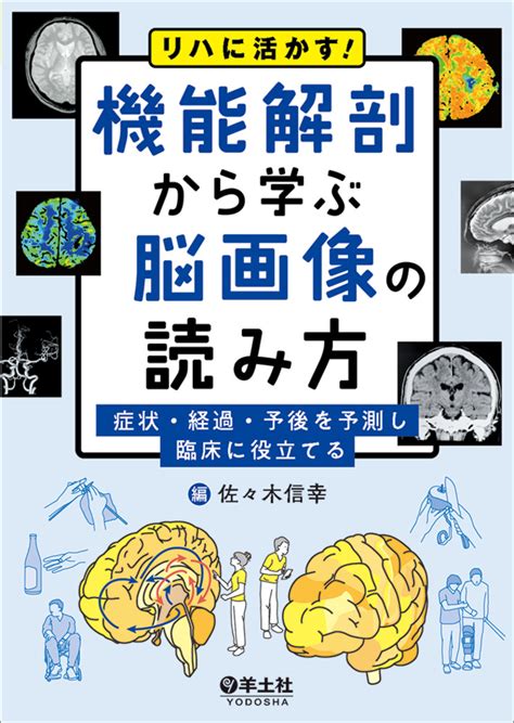 楽天ブックス リハに活かす！機能解剖から学ぶ脳画像の読み方 佐々木 信幸 9784758110037 本