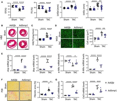 SENP1 Protects Against Pressure OverloadInduced Cardiac Remodeling And