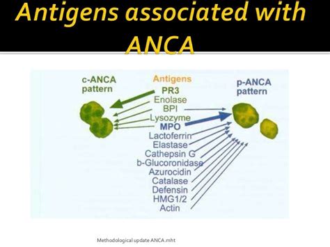 Anca Anti Neutrophil Cytoplasmic Antibodies Ancas