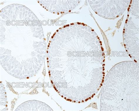 Seminiferous tubules, light micrograph | Stock Image - Science Source ...