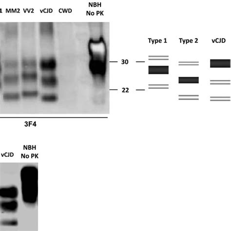 Western Blot Profile Of Human PrP Sc Generated In Vitro From CWD A