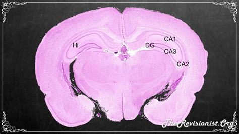 The Hippocampus Proper Role In Spatial Temporal Memory Processing And