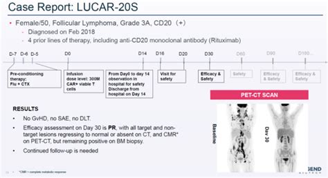 干货传奇生物公布实体瘤同种异体CAR T疗法最新进展附PPT 腾讯新闻