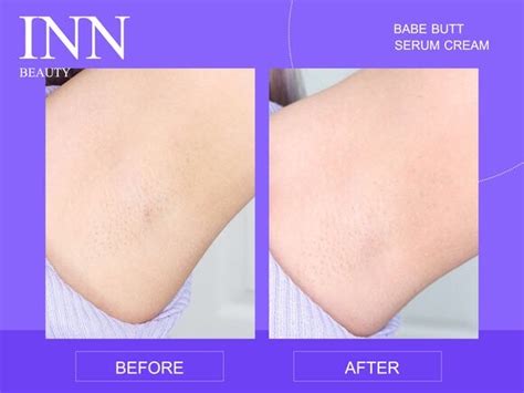 Inn Beauty Babe Butt Serum Cream 30 G อนน บวต เบบ บตต เซรม ครม เคลยรความคลำ สำหรบ