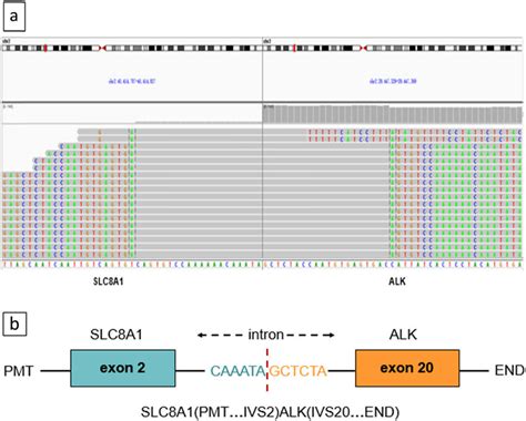 A Sequencing Reads Of ALK And SLC8A1 Are Shown By The Integrative