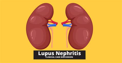 Lupus Nephritis Types