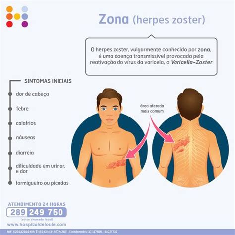 O Que É Herpes Zoster E Quais Os Sintomas
