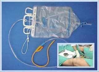 Cateterismo Vesical Sondagem Vesical Cuidados De Enfermagem