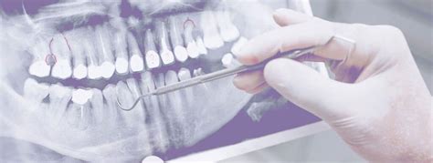 Risks of Dental Implants | Mile High Implant Centers