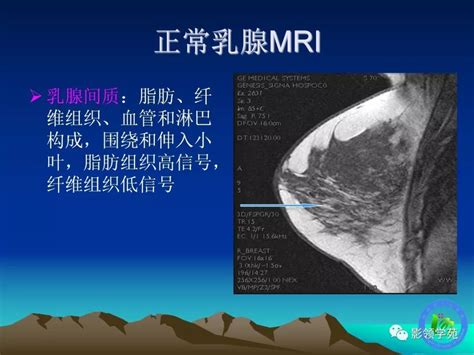 乳腺病变磁共振基本征象分析与诊断进展 检查