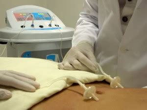 Carboxiterapia O Que E