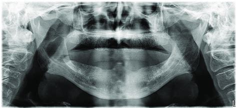 Clinical (a) view and panoramic X-ray (b) at initial examination ...