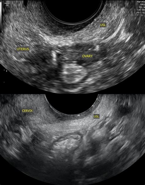 A Pictorial Guide To The Ultrasound Identification And Assessment Of