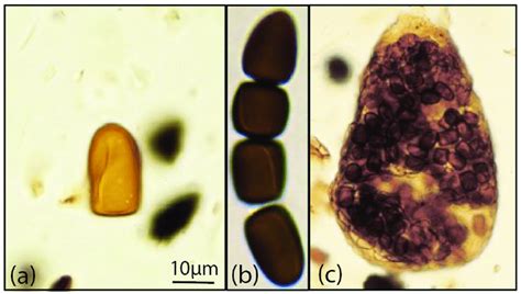 Microscope Images Of A Sporormiella Separate Cell Of Ascospore B