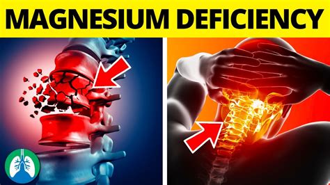 Top Symptoms Of Magnesium Deficiency Boost Magnesium Youtube