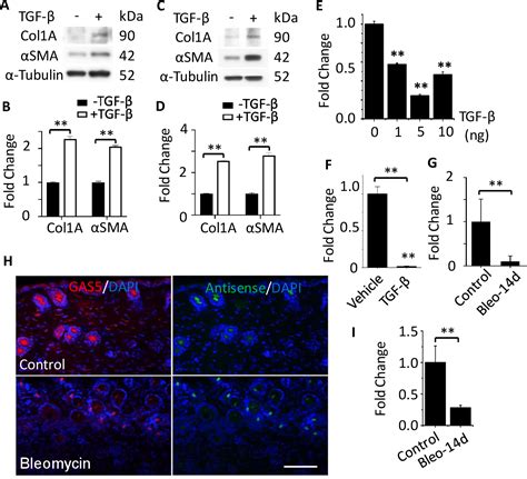 Figure 1 From LncRNA GAS5 Attenuates Fibroblast Activation Through