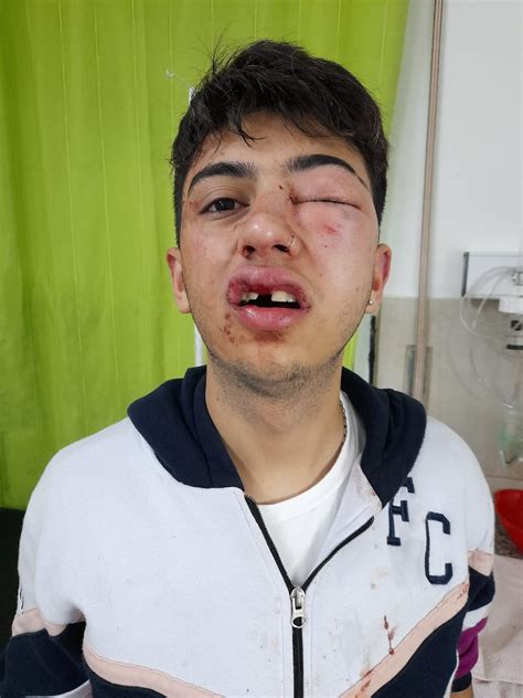 JOVEN DE JUSTINIANO POSSE BRUTALMENTE GOLPEADO