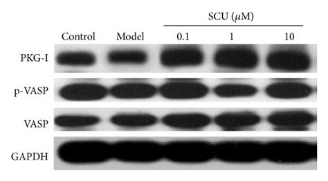 The Effect Of SCU On The Protein Level Of PKG I VASP And P VASP In HR