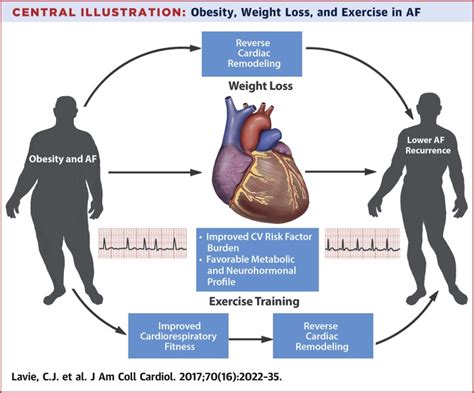 Obesity And Atrial Fibrillation Prevalence Pathogenesis And Prognosis