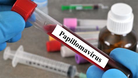 Le vaccin contre les papillomavirus est recommandé aussi aux garçons