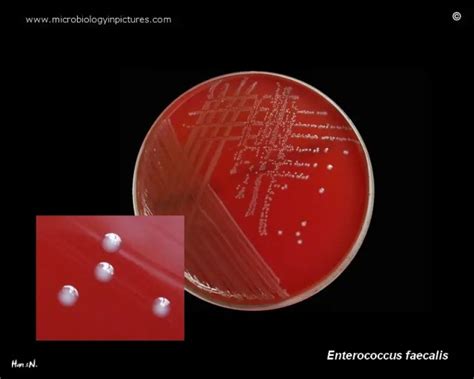 Enterococcus Faecalis Properties Pathogenesis Lab Diagnosis • Microbe Online