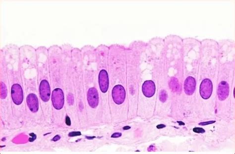 Epitelio simple Histología Celulas Membrana basal