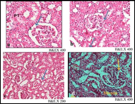 Photomicrographs Of The Kidney Section Of A Control Rat Showing The